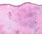 Лимфоидная ткань Строение и роль лимфоидной ткани в деятельности иммунной системы